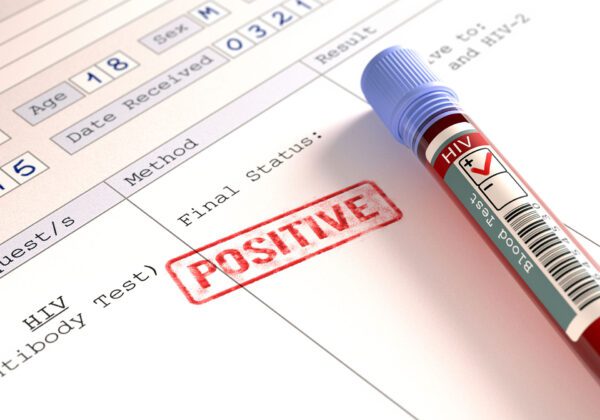 HIV/AIDS Update-Technician